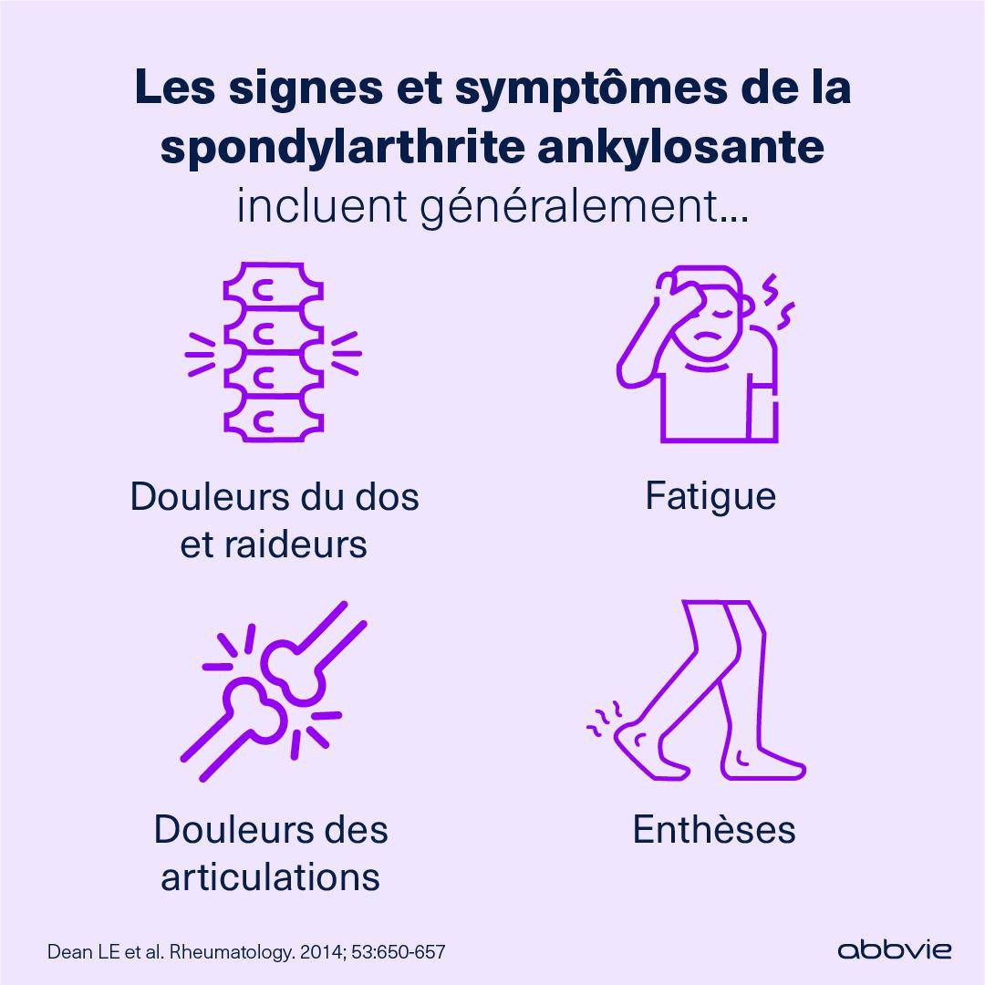 Lee signes et symptômes de la spondylarthrite ankylosante